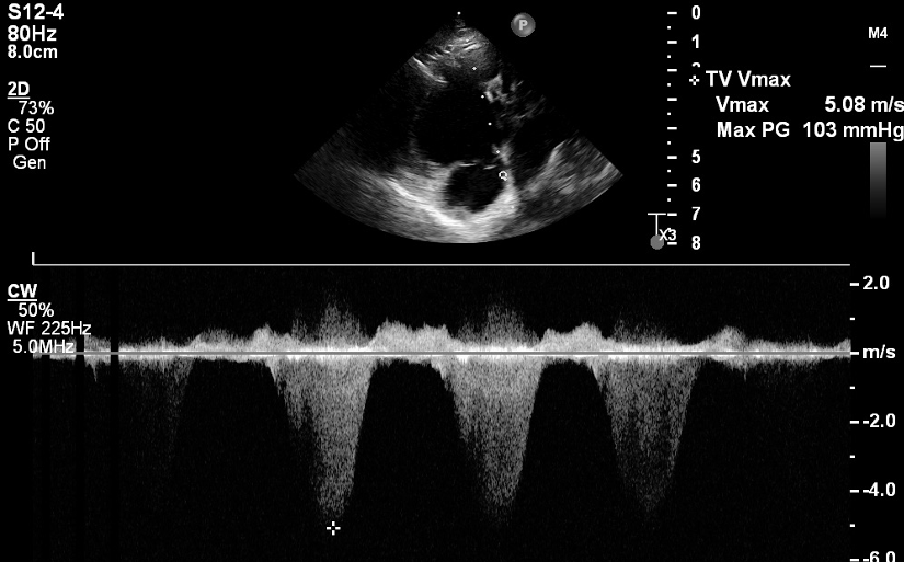 Echocardiography